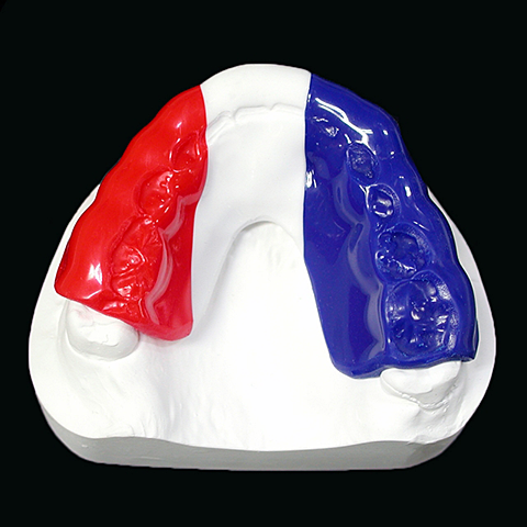 スポーツマウスガード